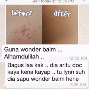 wbalm untuk kayap